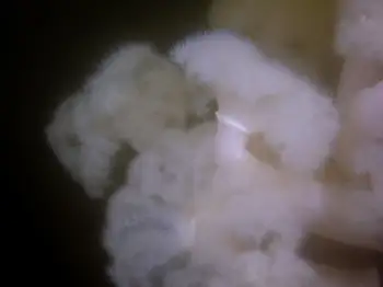 Metridium Anemones